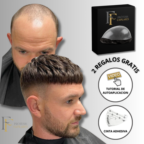FF Custom - Prótesis Capilar Premium