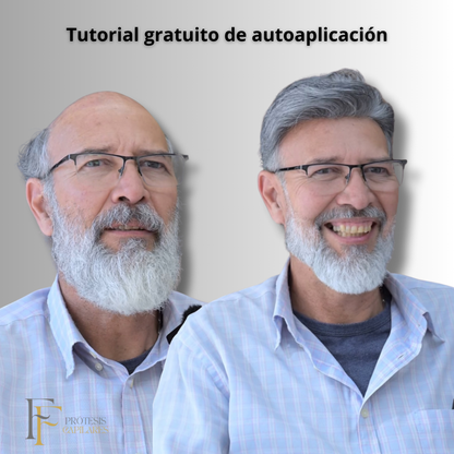 FF Custom - Prótesis Capilar Premium