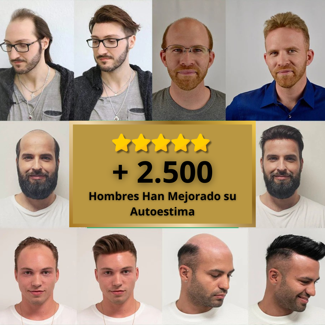 FF Custom - Prótesis Capilar Premium