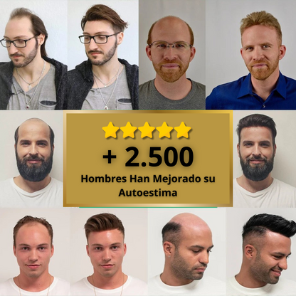 FF Custom - Prótesis Capilar Premium