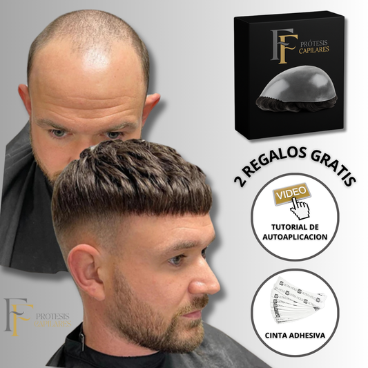 FF Custom - Prótesis Capilar Premium