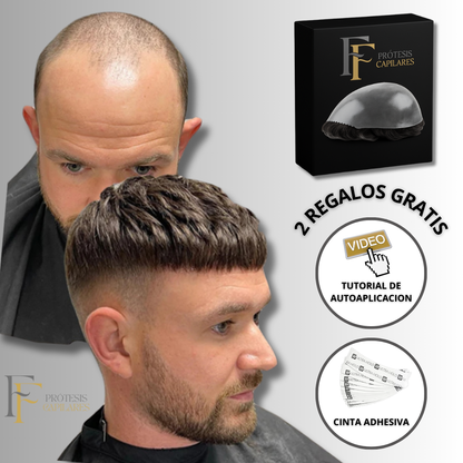 FF Custom - Prótesis Capilar Premium